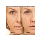 Revitalift Laser Soin Anti-Âge Jour