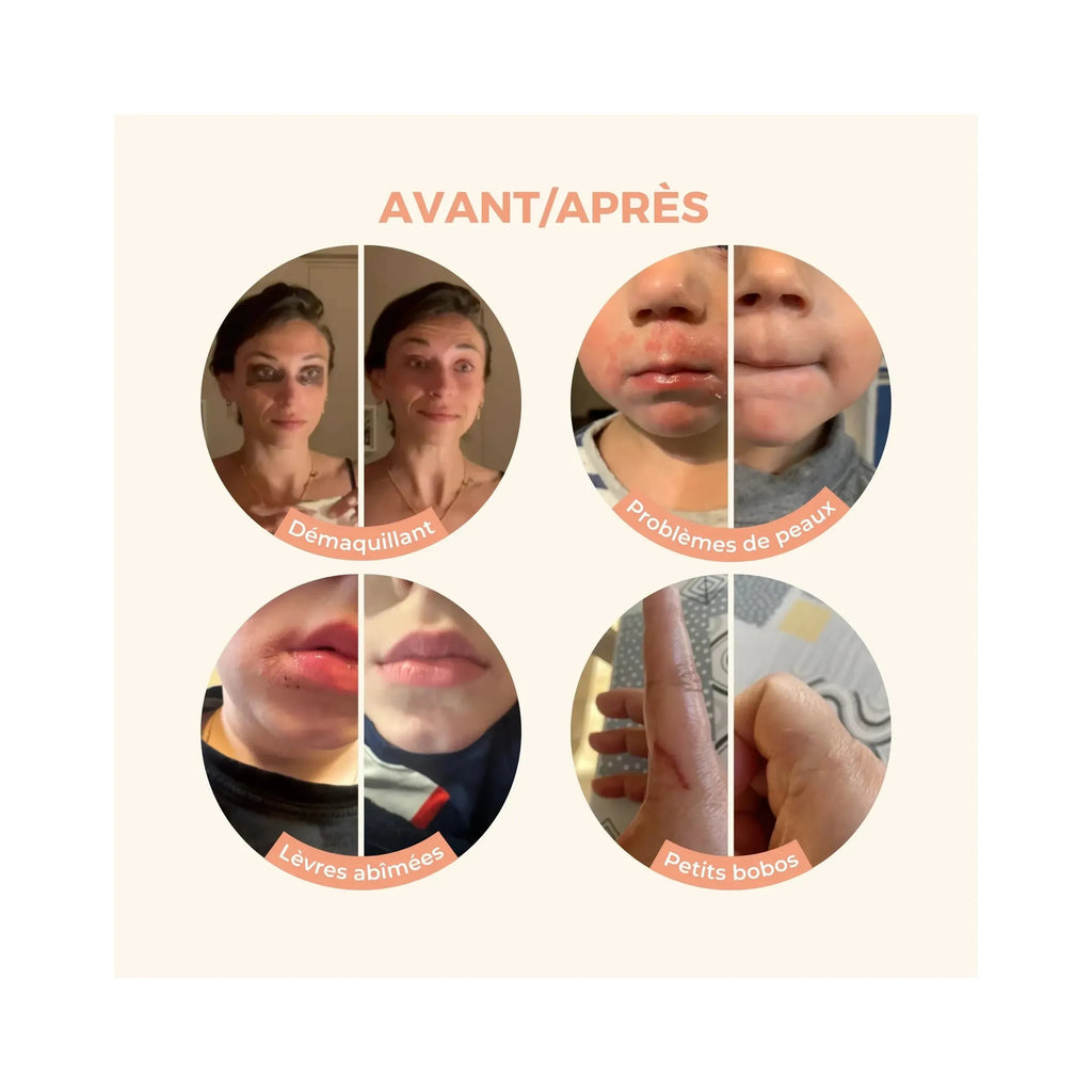 Antes/Después de Magic Balm Reseña del cliente Removedor de maquillaje para eczema