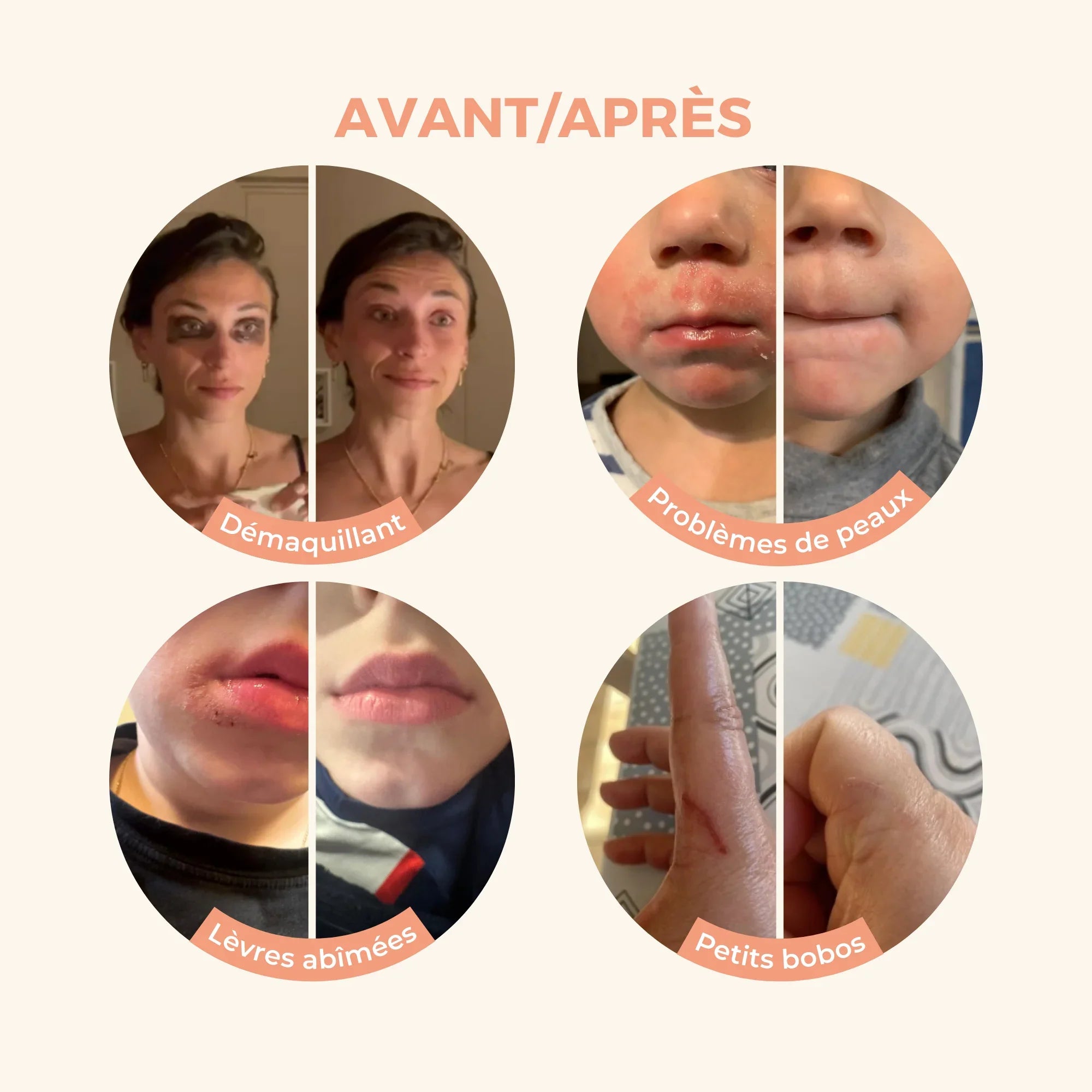 Antes/Después de Magic Balm Reseña del cliente Removedor de maquillaje para eczema