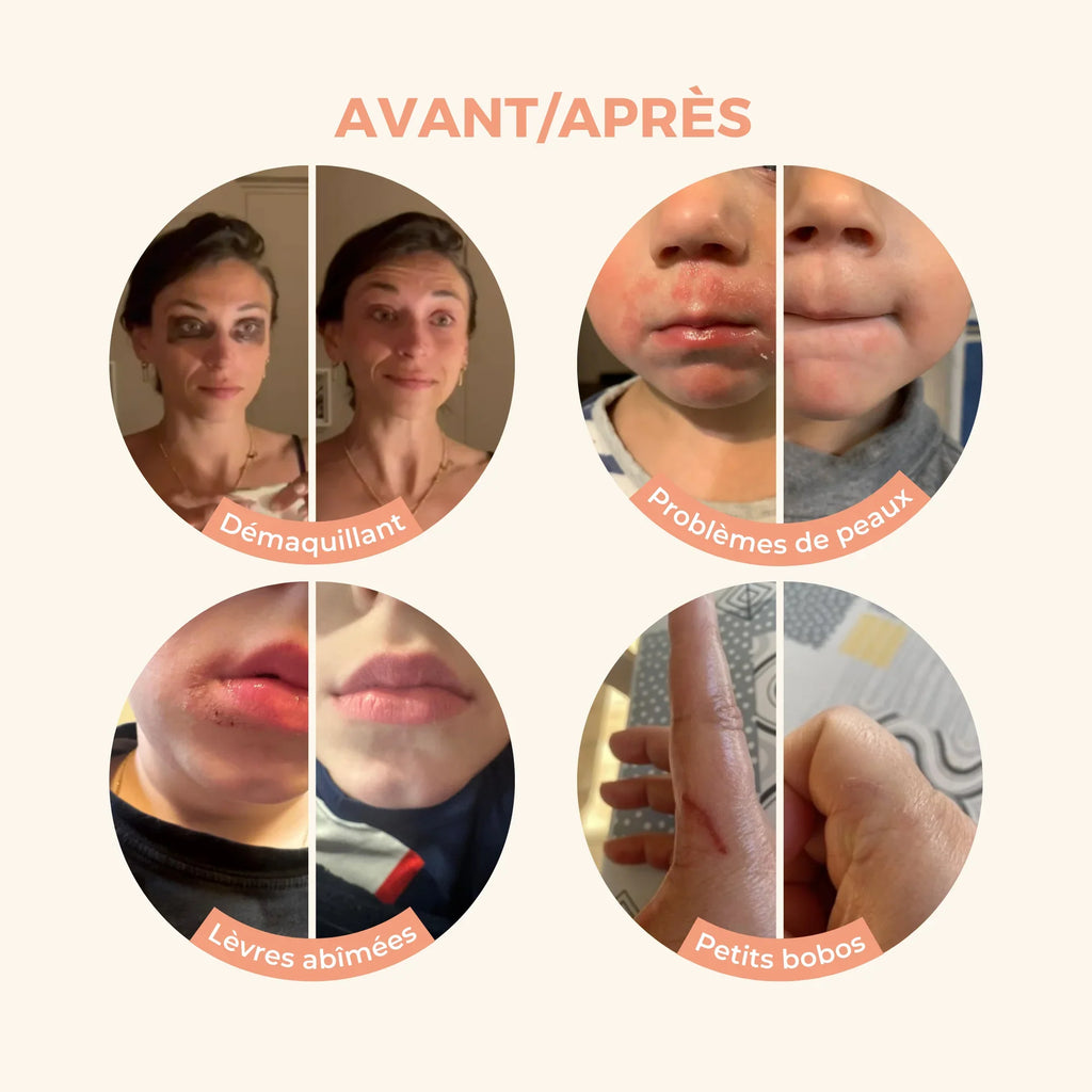Antes/Después de Magic Balm Reseña del cliente Removedor de maquillaje para eczema