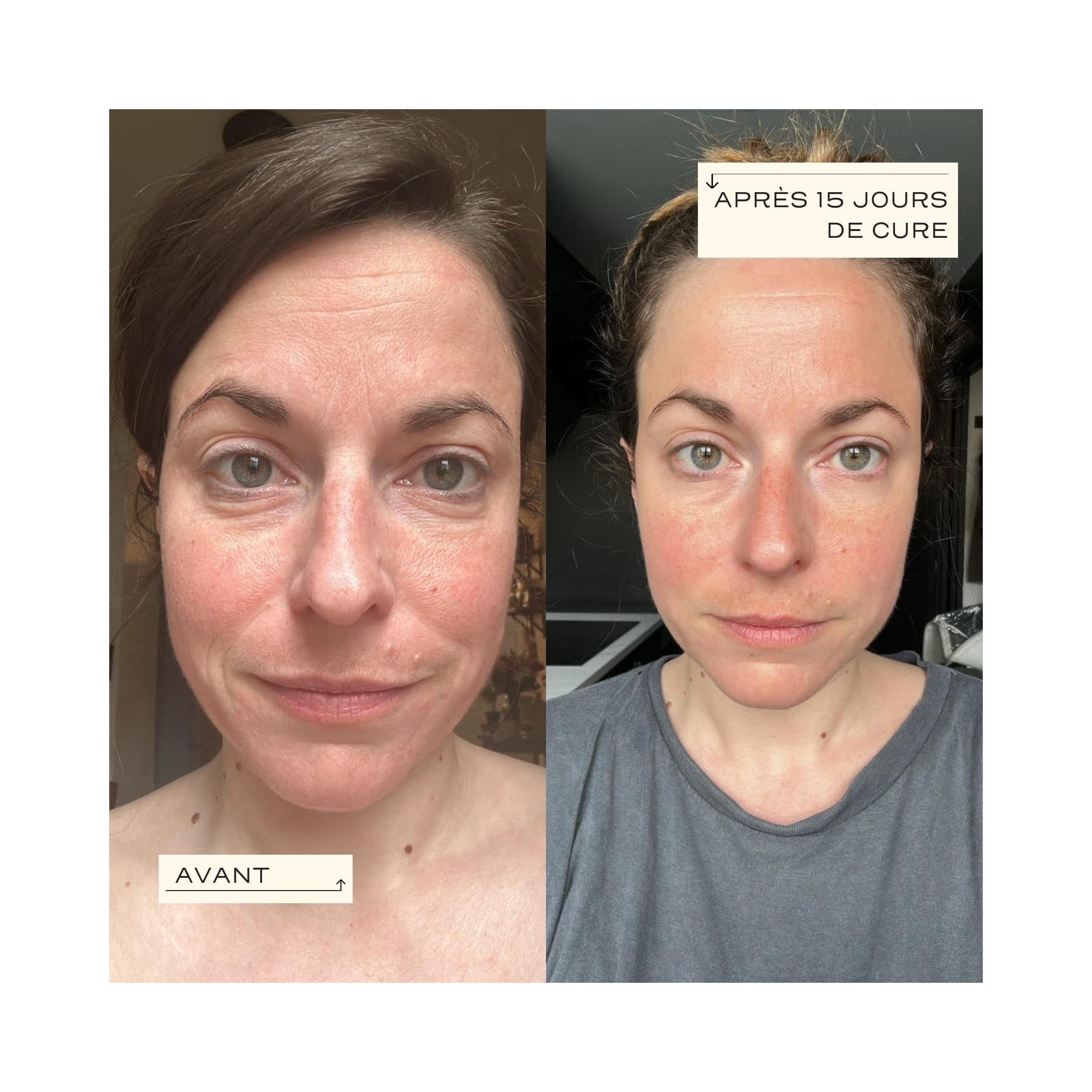 Collagen Essential - Régénération & Élasticité De La Peau