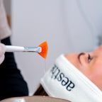 PRX-T33® & Microneedling – Effet Peau Neuve
