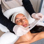 PRX-T33® & Microneedling – Effet Peau Neuve