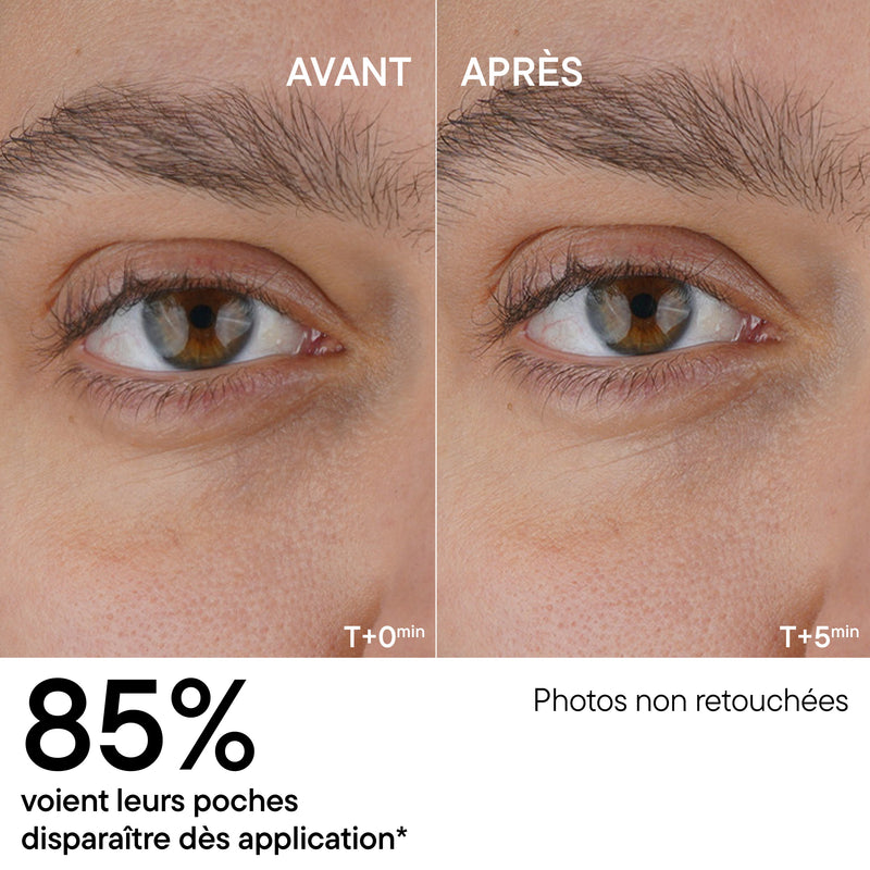 Anti-fatigue Eye Serum