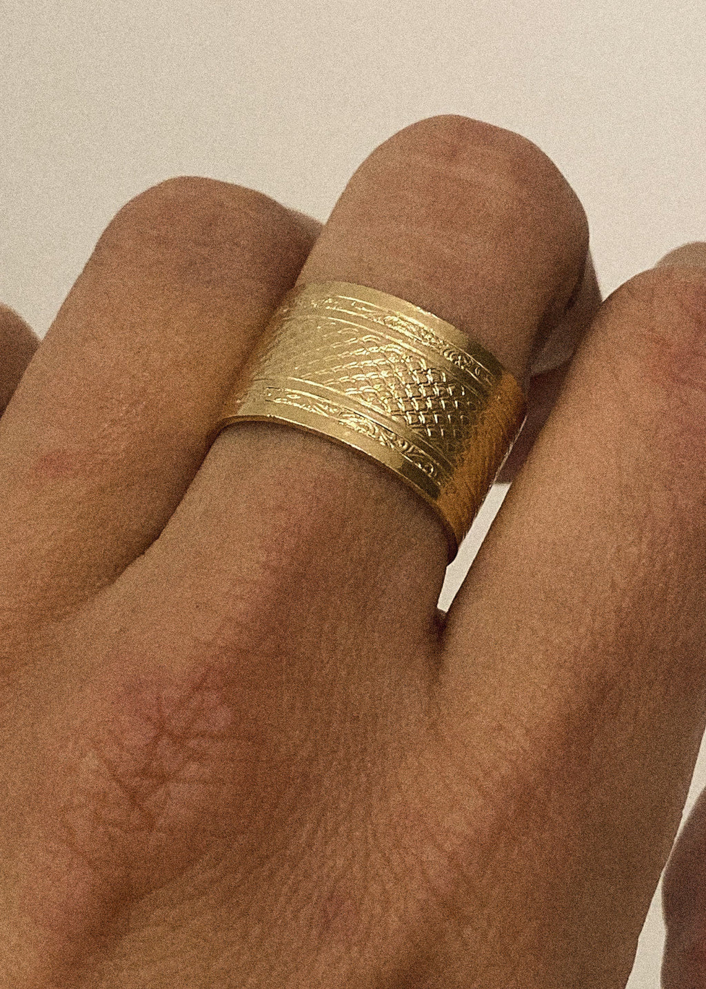 Anello Mala