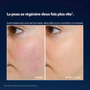 Mascarilla nocturna antised