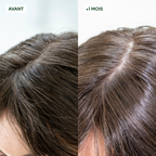 Gommage Actif Anti-Pelliculaire