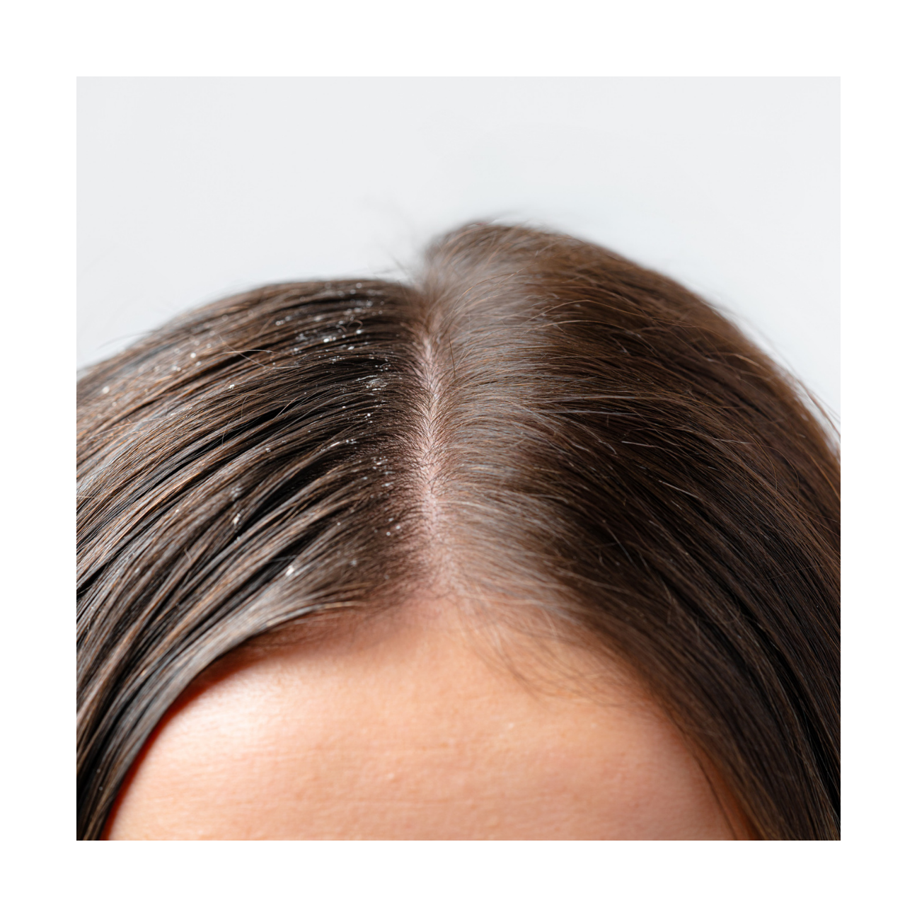 Gommage Actif Anti-Pelliculaire