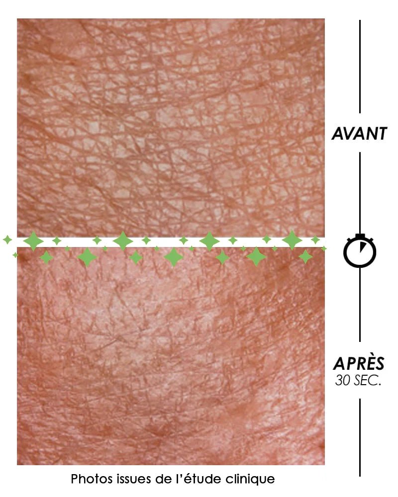 Macro close-up of a Garancia clinical study showing skin texture before and after 30 seconds of using Pschitt Magique. The skin relief is visibly smoothed and pores are tightened.